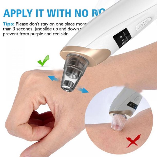 Electric Suction Blackhead Pore Cleaning